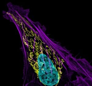 Célula mostrando en amarillo las mitocondrias, azul el ADN y en púrpura los filamentos de actina. Imagen: Dylan Burnette and Jennifer Lippincott-Schwartz, Eunice Kennedy Shriver National Institute of Child Health and Human Development, National Institutes of Health