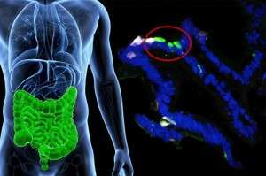 Células gastrointestinales de pacientes fueron modificadas para expresar insulina (mostrada en verde fluorescente). Imagen:  Columbia University Medical Center.