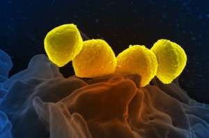 Microbioma. Bacteria del género Streptococcus. Imagen: National Institute of Allergy and Infectuous Diseases, EEUU)