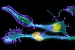 Células nerviosas en desarrollo. Imagen: Torsten Wittmann, University of California, San Francisco (a través de Image and Video Gallery, NIH)