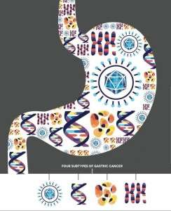 Esquema del estómago con la representación simbólica de los 4 subtipos de cáncer identificados. Imagen: Allison Kudla and Ryo Sakai, Institute for Systems Biology (Instituto Nacional de Salud, EEUU, http://www.genome.org)