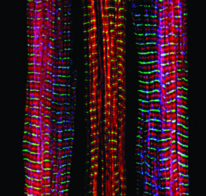 Tres fibras musculares, de las cuales la central carece de una proteína asociada a desórdenes musculares. Imagen: Christopher Pappas and Carol Gregorio, University of Arizona