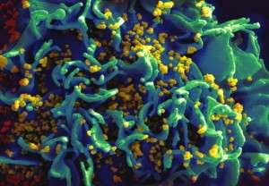 Linfocito T infectado por VIH By NIAID/NIH (NIAID Flickr's photostream) [Public domain], via Wikimedia Commons