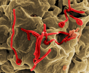 Partículas víricas de Ébola. Imagen: Center for Disease Control and Prevention. National Institute of Health, EEUU.