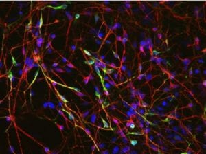 Neuronas diferenciadas a partir de células madre embrionarias. En verde, neuronas dopaminérgicas, principales células nerviosas afectadas en el Párkinson. Imagen: Xianmin Zeng lab, Buck Institute for Age Research, via CIRM
