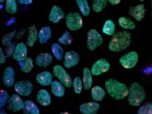 Células madre pluripotenciales inducidas a partir de las células de la piel. Imagen: Laboratorio de Kathrin Plath, University of California, Los Angeles