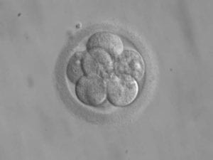Embrión de 8 células fecundación in vitro. Imagen :By ekem, Courtesy: RWJMS IVF Program [Public domain], via Wikimedia Commons