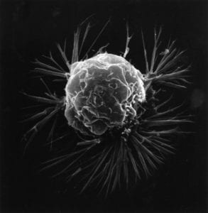 ADN tumoral circulante. Imagen: National Cancer Institute.