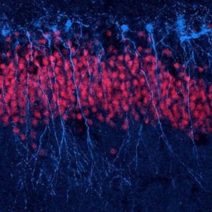 Tejido cerebral mostrando axones y dendritas de las neuronas en azul. Imagen: Jason Snyder (CC BY 2.0 http://creativecommons.org/licenses/by/2.0/)