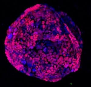 Imagen de cultivos de organoides intestinales. El silenciamiento del gen APC activa una respuesta de tipo cáncer. Imagen: Kevin P. O’Rourke.