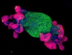 Imagen de cultivos de organoides intestinales. La reactivación de APC restaura la división normal de las células intestinales. Imagen: Kevin P. O’Rourke.