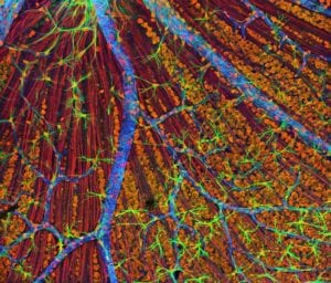 distrofia de la retina. Imagen: Tom Deerinck, National Center for Microscopy and Imaging Research