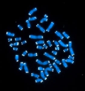 Cromosomas y telómeros. Imagen: Hesed Padilla-Nash y Thomas Ried (Instituto Nacional de Salud, EE.UU.) 
