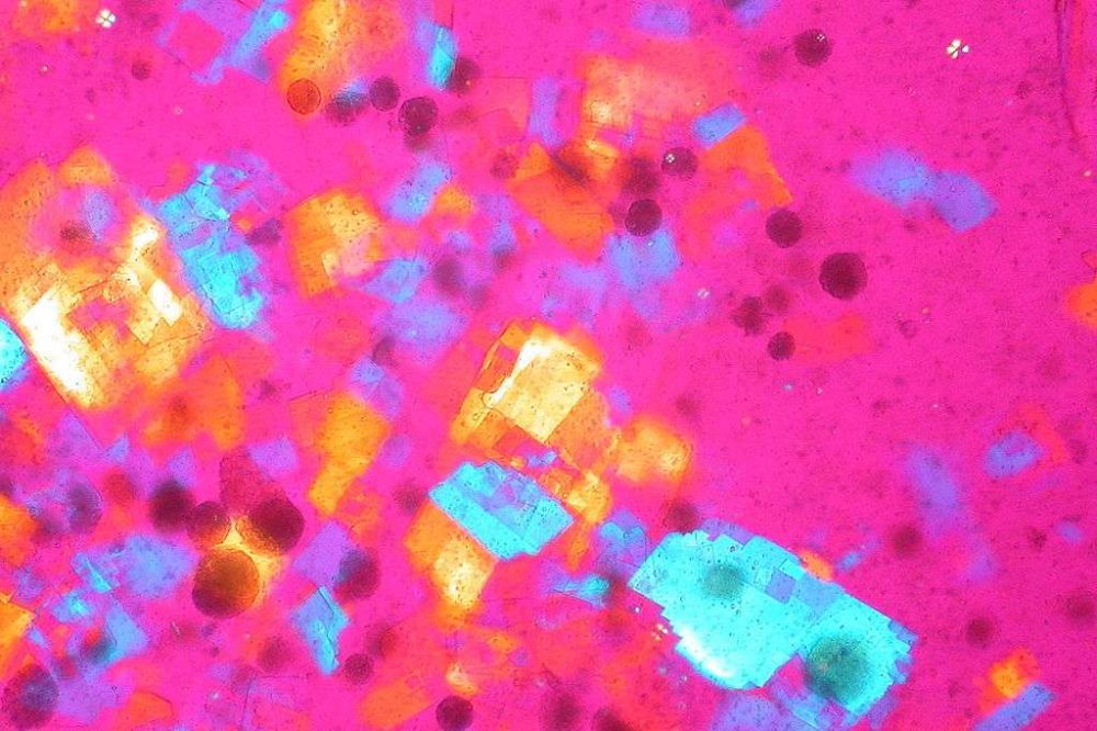 1024px Cholesterol Crystals Synovial Fluid Polarized Light Jpg Genotipia   1024px Cholesterol Crystals Synovial Fluid Polarized Light 1000x666 