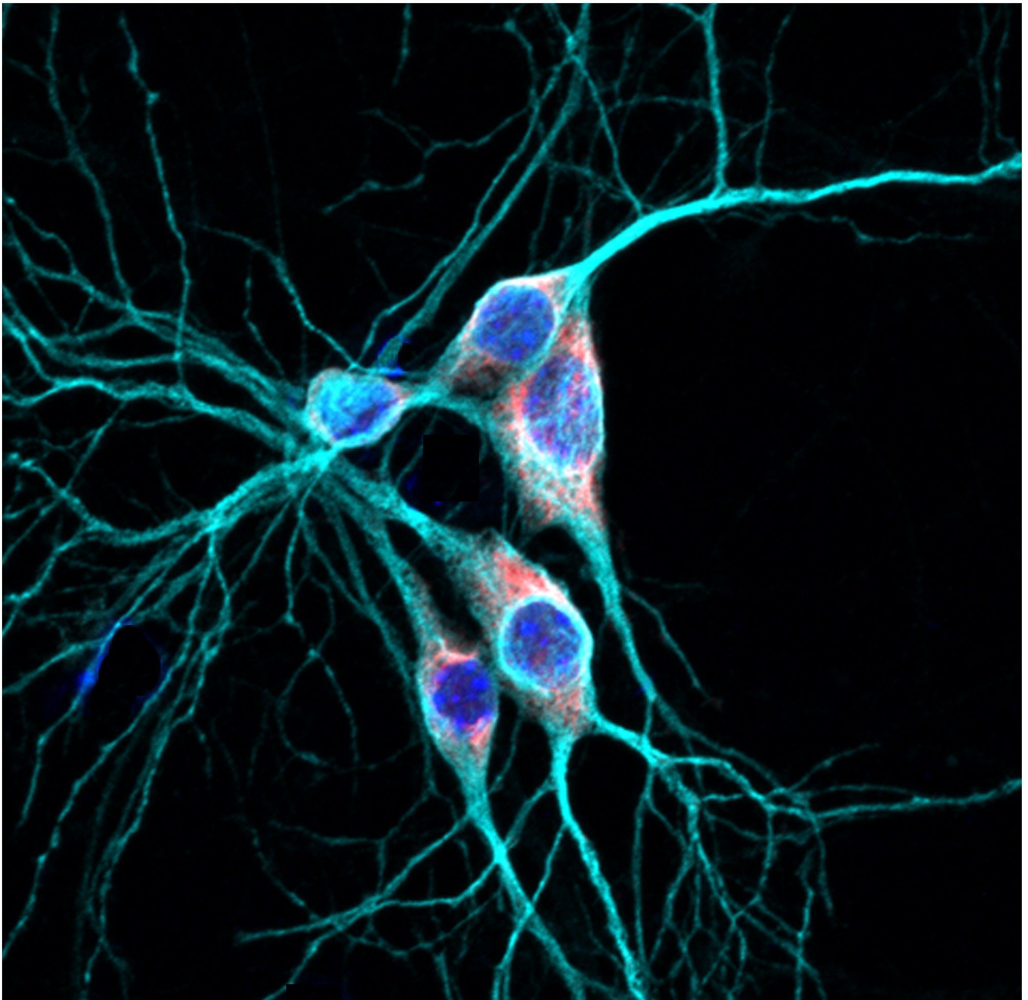 Восстановление клеток мозга. Нейроны. Нейробиология генетика. Розово синий фон Нейроны.