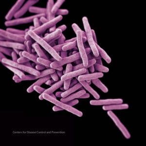 resistencia tuberculosis