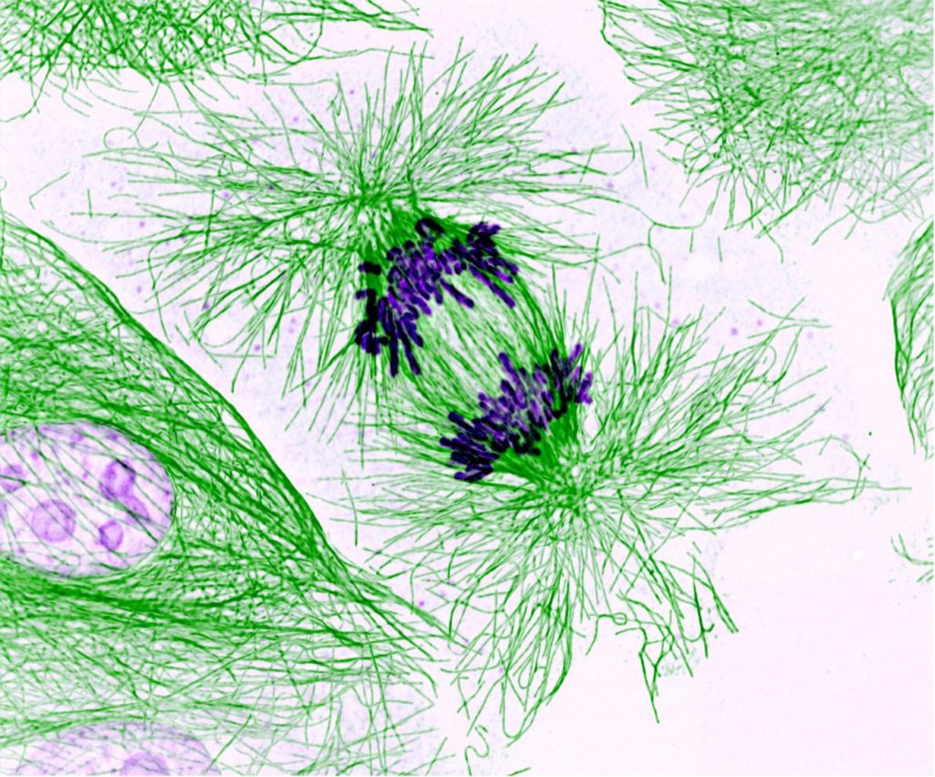 Células en división. Los cromosomas, en morado, se han duplicado y la separación de los dos juegos hacia las correspondientes células hijas es dirigida por las fibras del citoesqueleto (en verde). La proteína hSpindly interviene en este proceso. Imagen: Nasser Rusan, National Heart, Lung, and Blood Institute, National Institutes of Health.