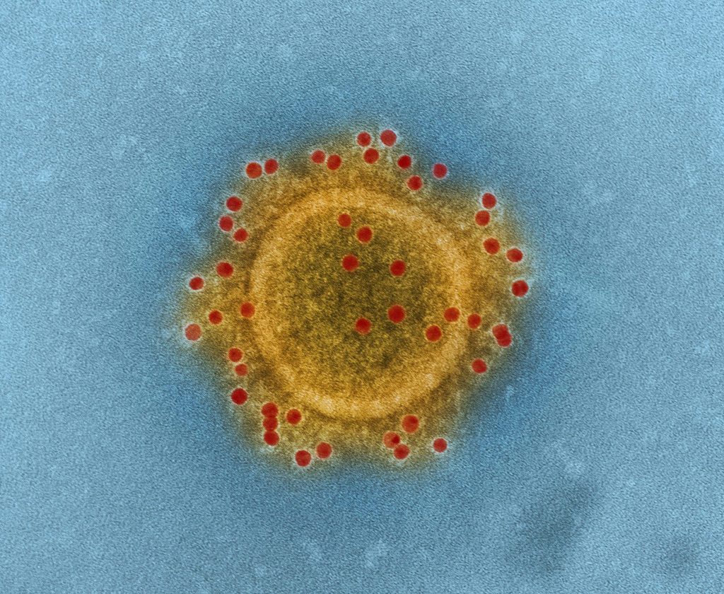 Coronavirus NIAID - Genotipia