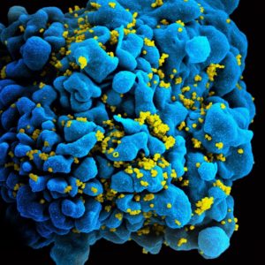 CRISPR infección latente VIH