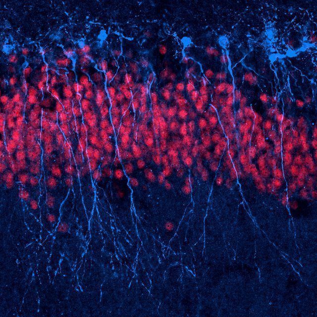 neuronas rompen su ADN