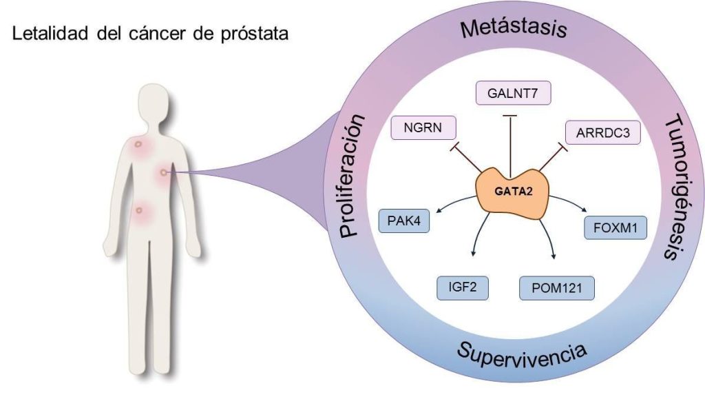 tratamiento por etapas del cáncer de próstata