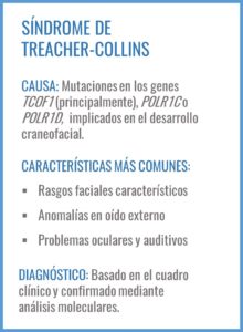 Treacher-Collins