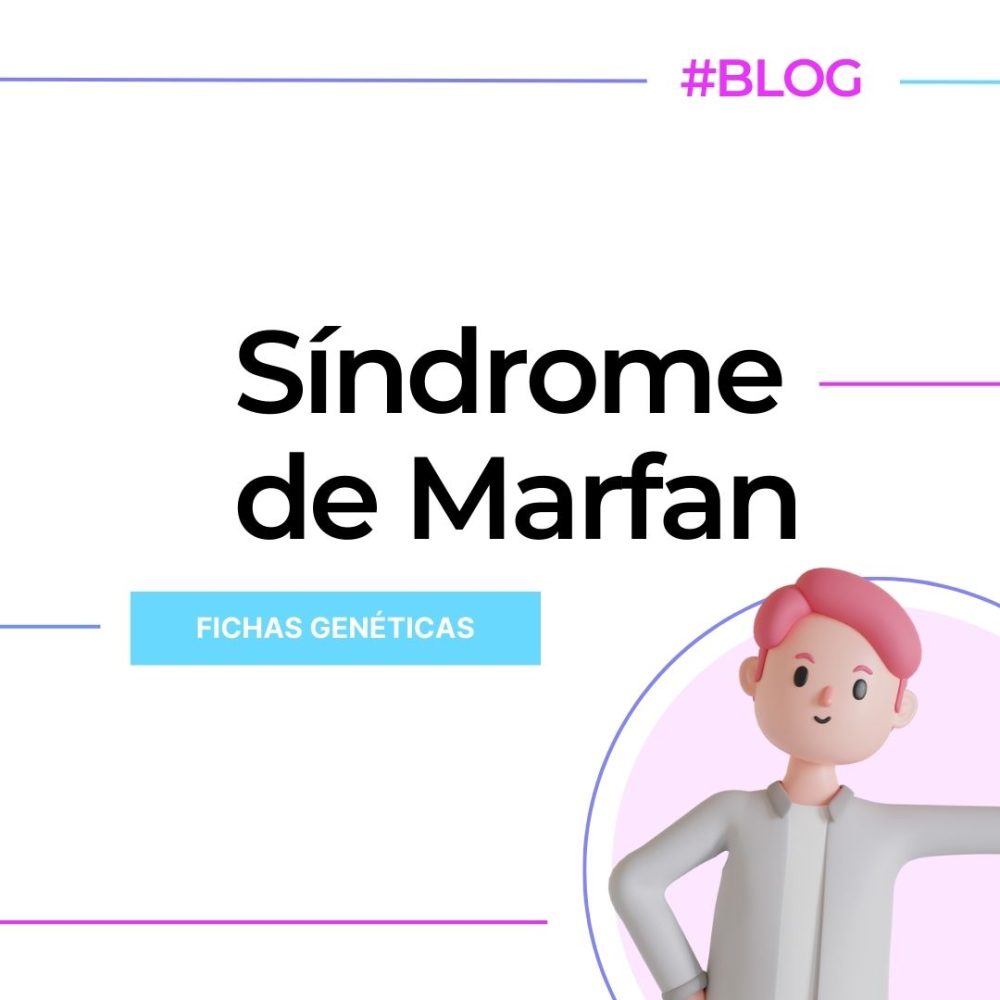 Fichas Genéticas Síndrome De Marfan Genotipia