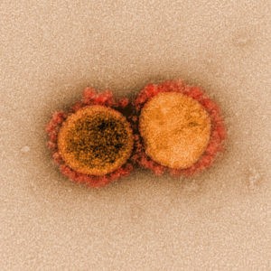 genoma pacientes coronavirus