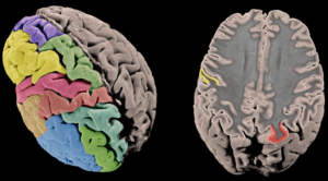 mapa genético corteza cerebral