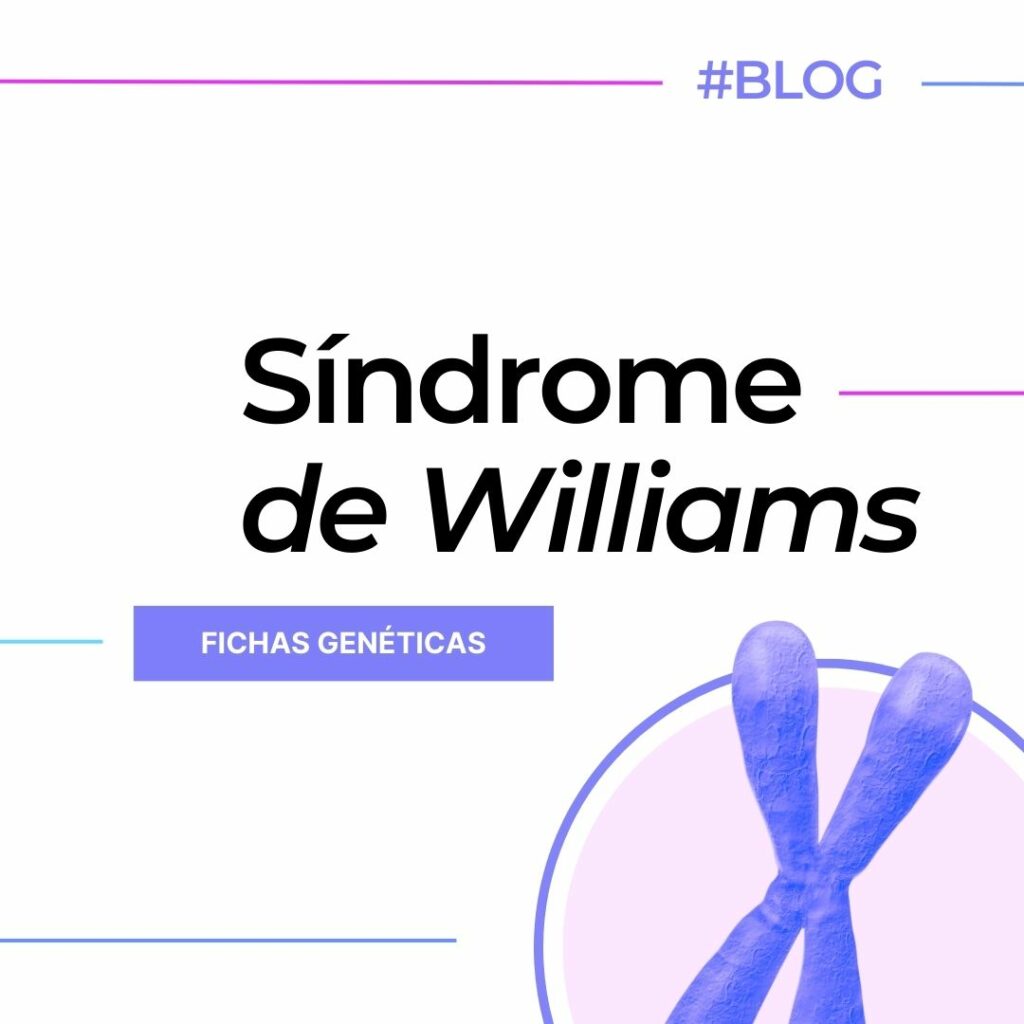 sindrome de williams - blog