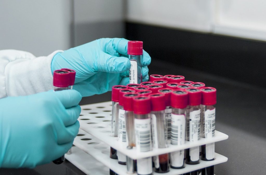 test sangre tumores cerebrales