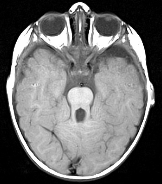molar sign tooth Genotipia