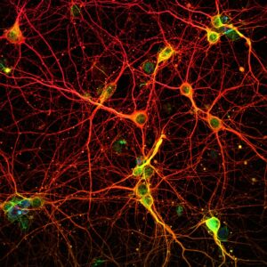 reparación del ADN neuronas