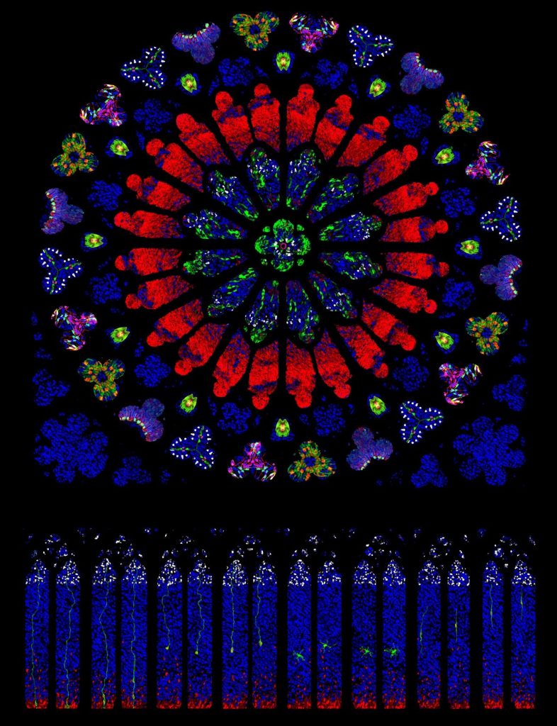 roseta instituto de neurociencias en alicante