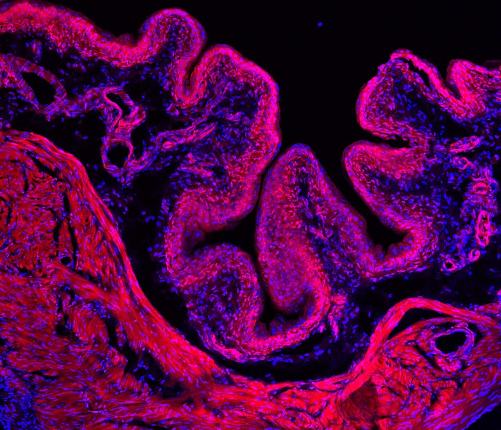 vejiga genes cerebro orinar