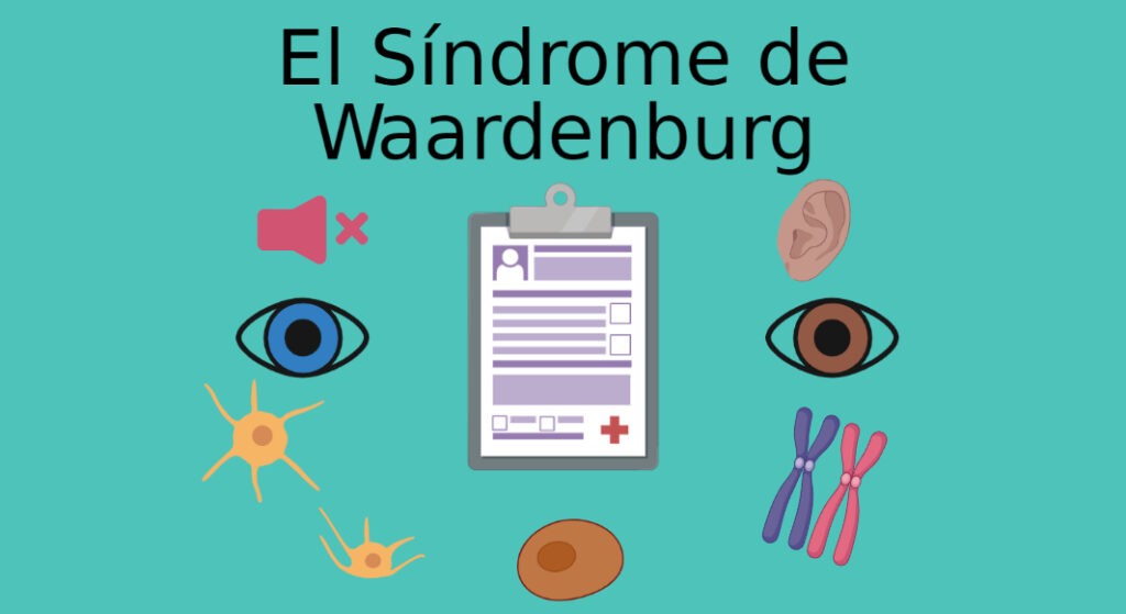 Síndrome de Waardenburg