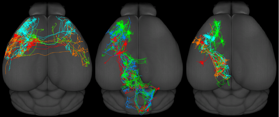 tipos celulares cerebro
