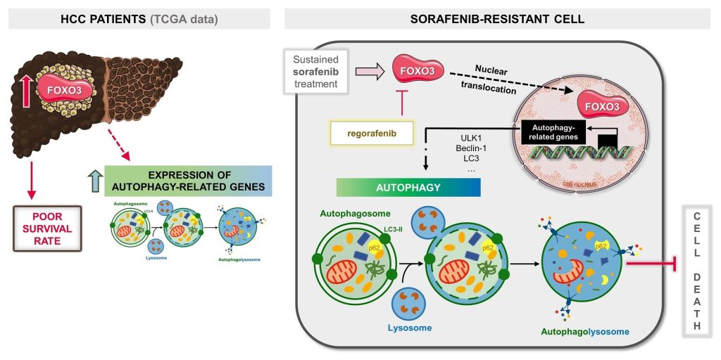 mecanismos implicados resistencia quimioterapia cancer higado
