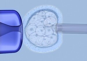 poligénicos seleccionar embriones genética