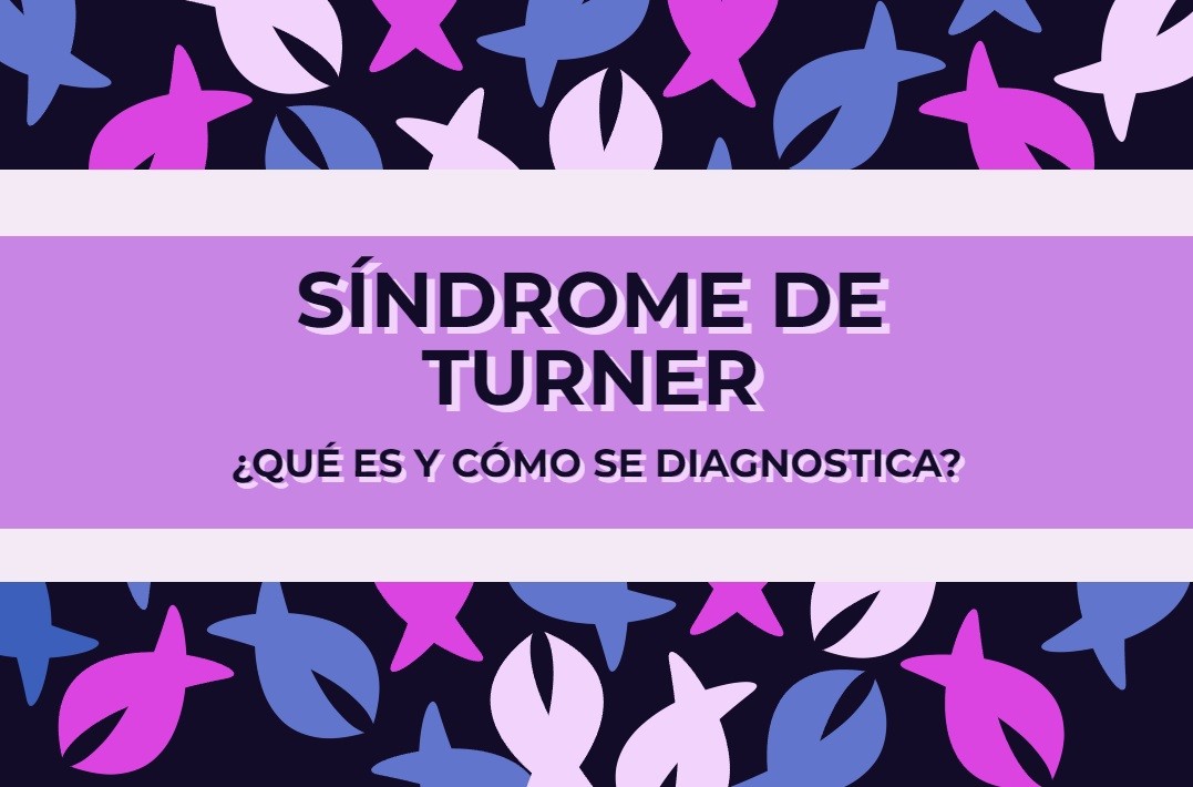 Síndrome De Turner ¿qué Es Y Cómo Se Diagnostica Genotipia