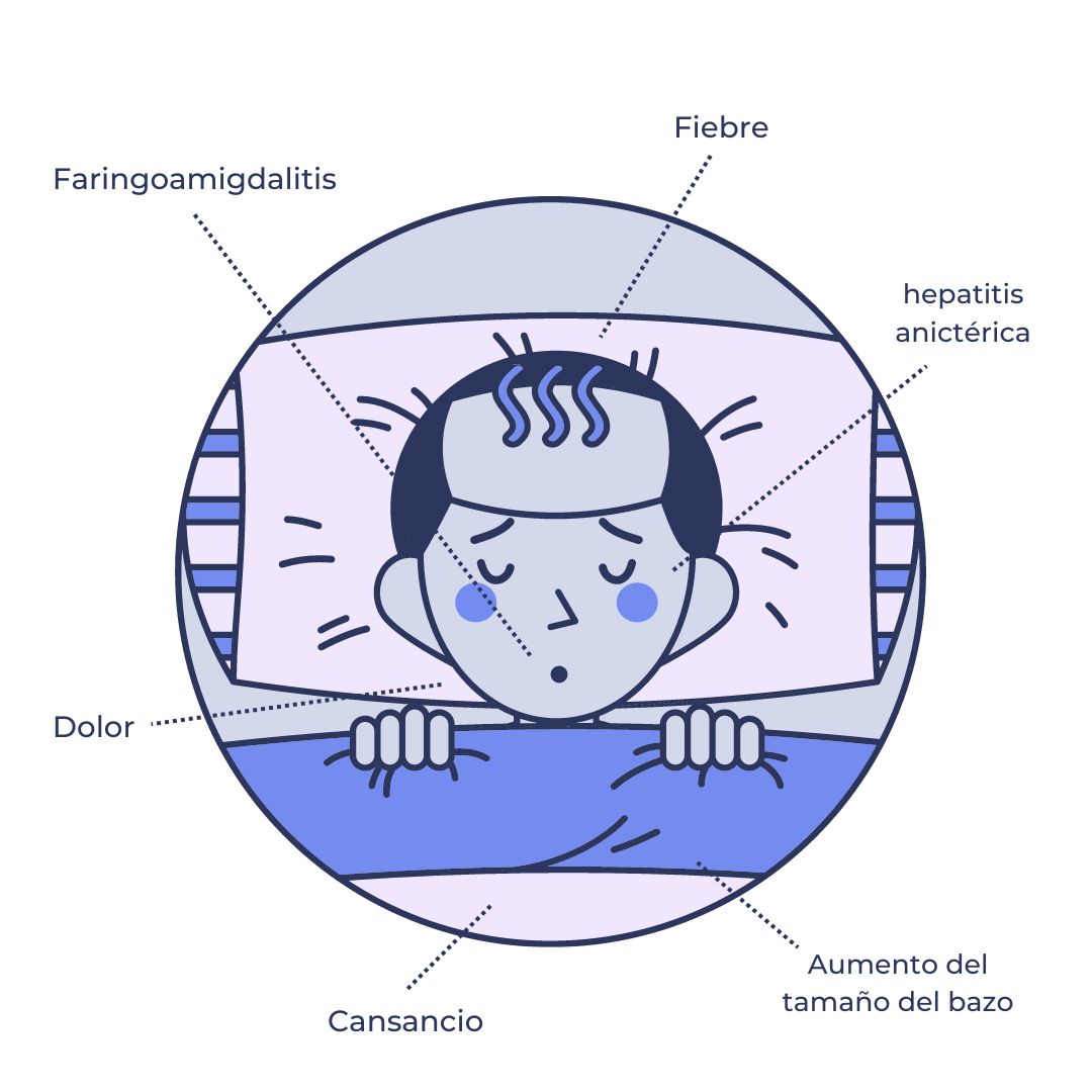 sintomas virus epstein-barr