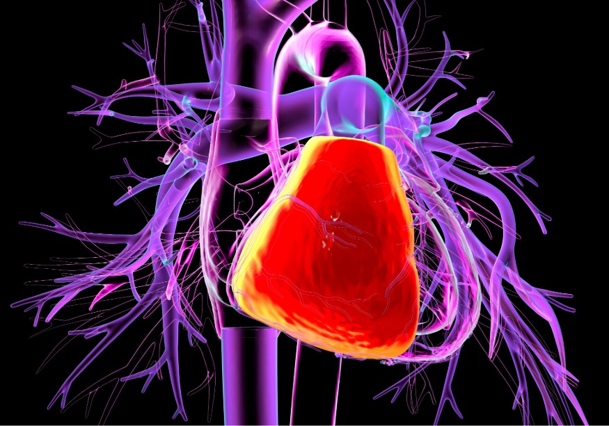 La estenosis pulmonar consiste en un bloqueo del flujo sanguíneo desde el ventrículo derecho hacia la arteria pulmonar, como consecuencia de un estrechamiento de la válvula pulmonar. En esta imagen se muestra el corazón humano con el ventrículo derecho resaltado en rojo. Imagen: Adobe Express.
