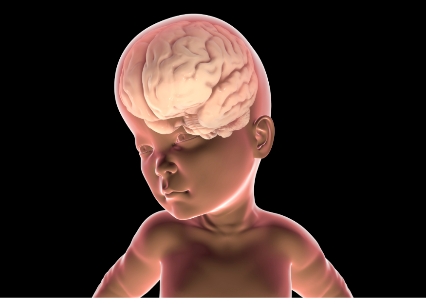 Uno de los rasgos característicos del síndrome de Sotos es la macrocefalia, que suele empezar a manifestarse en las primeras etapas del desarrollo embrionario. Imagen: Adobe Express.