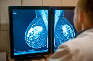 análisis mutaciones cáncer de mama