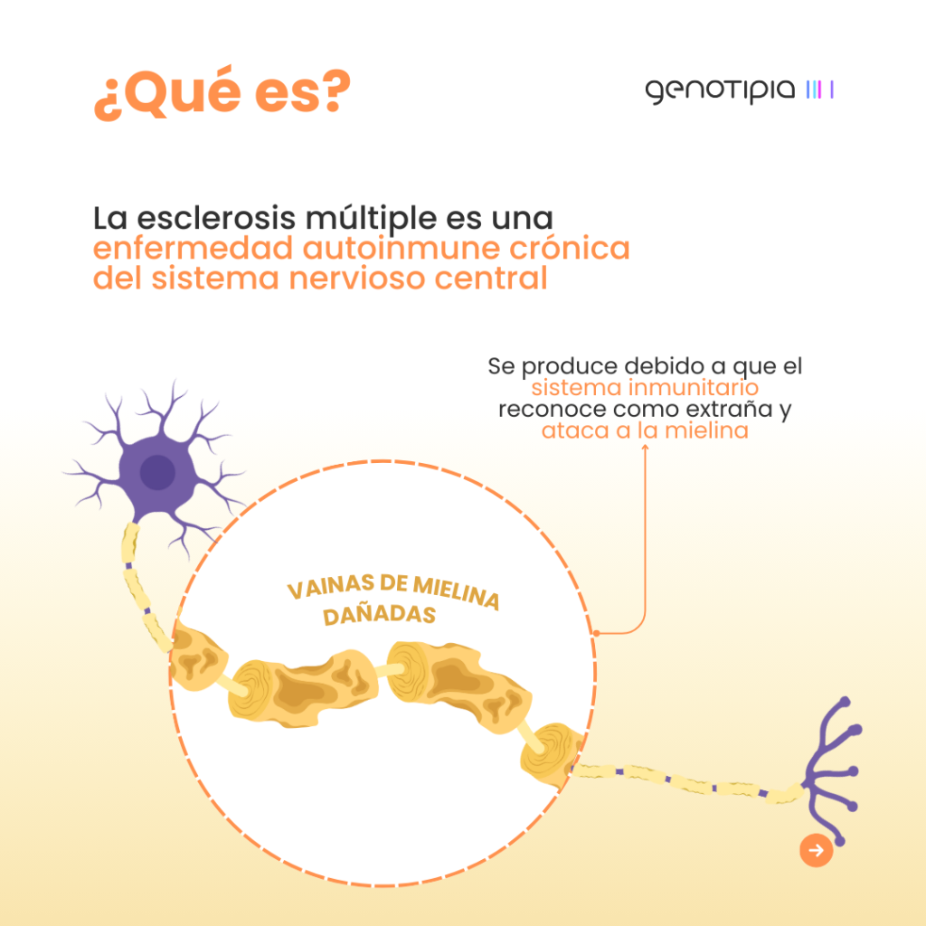 Esclerosis múltiple