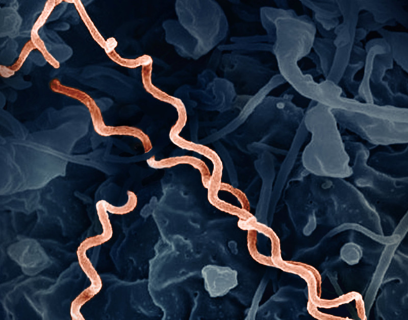 El análisis metagenómico puede mejorar el diagnostico de infecciones difíciles de diagnosticar. Imagen: Micrografía electrónica coloreada de Treponema pallidum bacteria que produce sífilis. Si la bacteria llega al cerebro puede causar neurosífilis. Fuente: NIAID. 