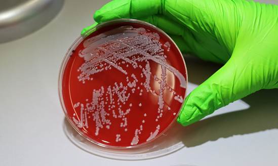 Staphylococcus aureus creciendo en una placa de agar sangre. Fotografía tomada en el laboratorio de Respiratory Virus and Microbiome Initiative del Instituto Wellcome Sanger, Reino Unido. 