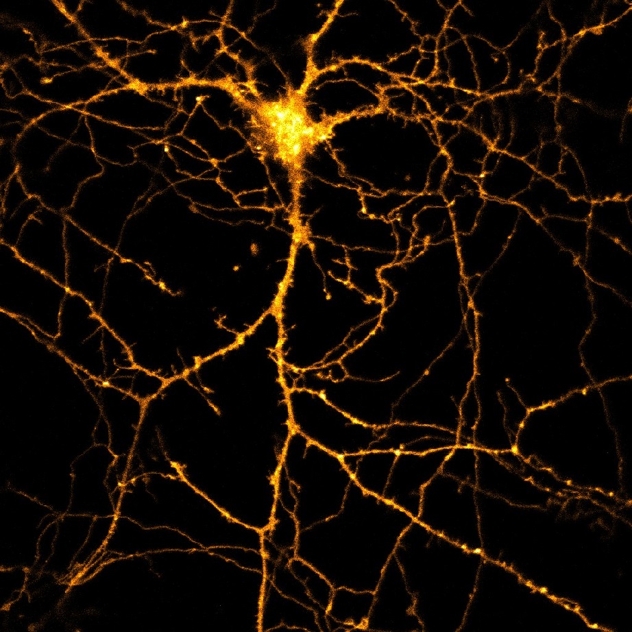 Expresión de la proteína H-Ras en una neurona del hipocampo. Imagen: J.A. Esteban 