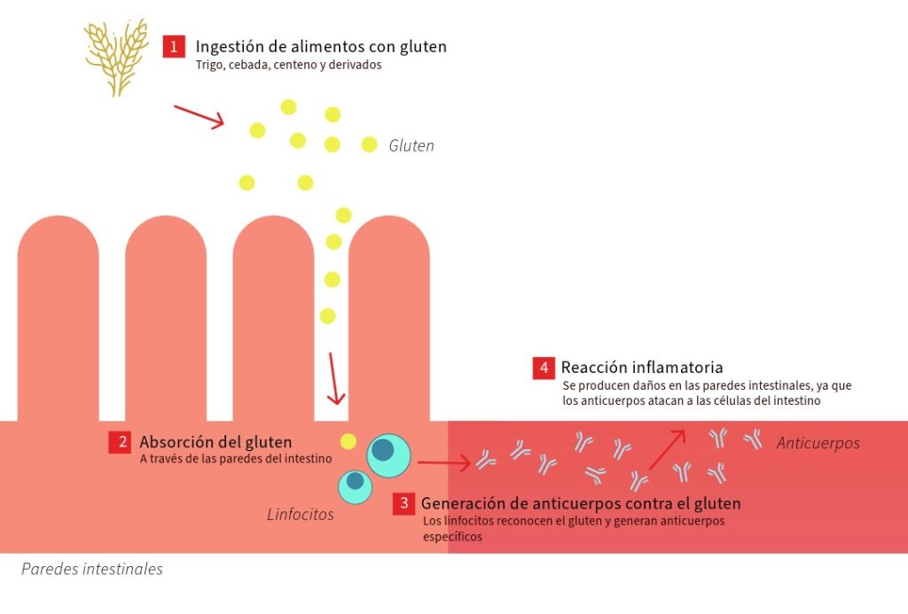 intestino delgado gluten celiaquía