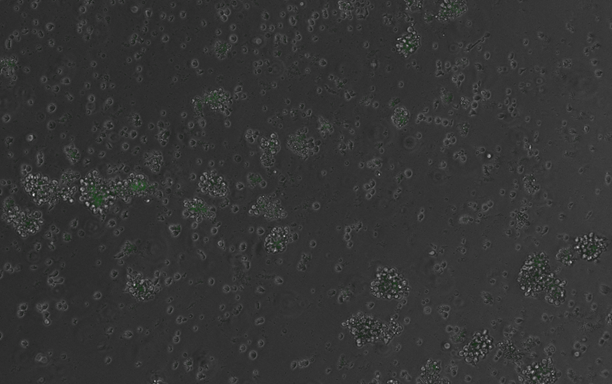 Células con gen de fluorescencia activado por un elemento regulador diseñado por IA, un ejemplo de biología generativa. Imagen: Aina Bernal Martinez/Centro de Regulación Genómica.